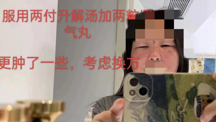 饮酒后面目红肿